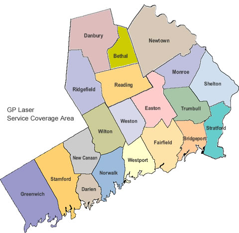 GP Laser Service Area's
